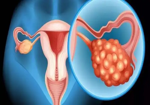 寧波試管助孕價(jià)格：怎樣通過孕檢單判斷胎兒性別？教你正確看懂孕檢單